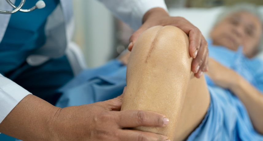 Do You Really Need a Knee Replacement