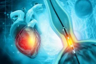 Coronary Angiography
