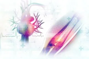 Coronary Angioplasty