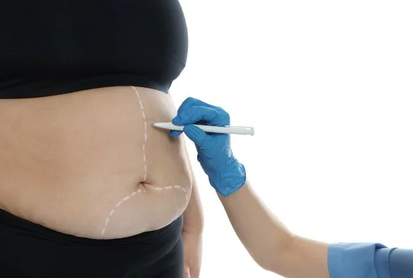 Bariatric