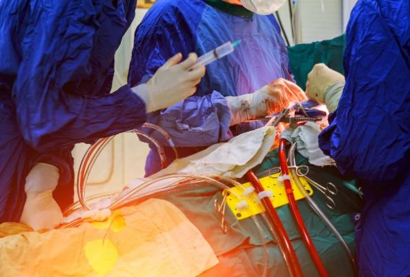 cardio surgery